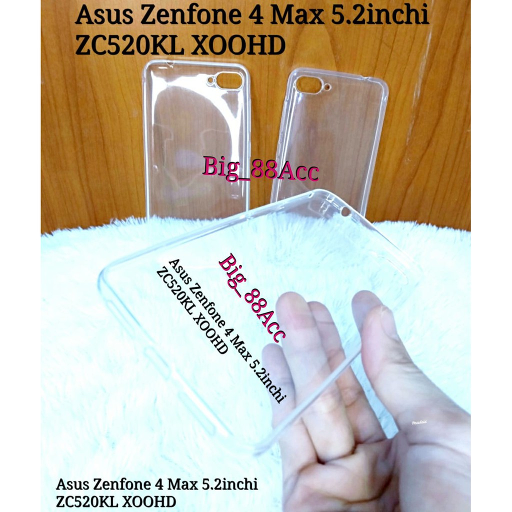 Soft Case Silicon Clear Asus Zenfone 4 Max 5.2inchi ZC520KL X00HD