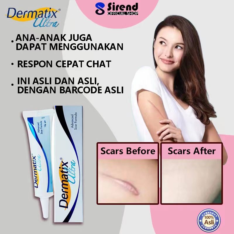 Dermatix Ultra Gel 15g dermatix penghilang bekas luka penghilang bekas luka dermatix ultra dermatix 