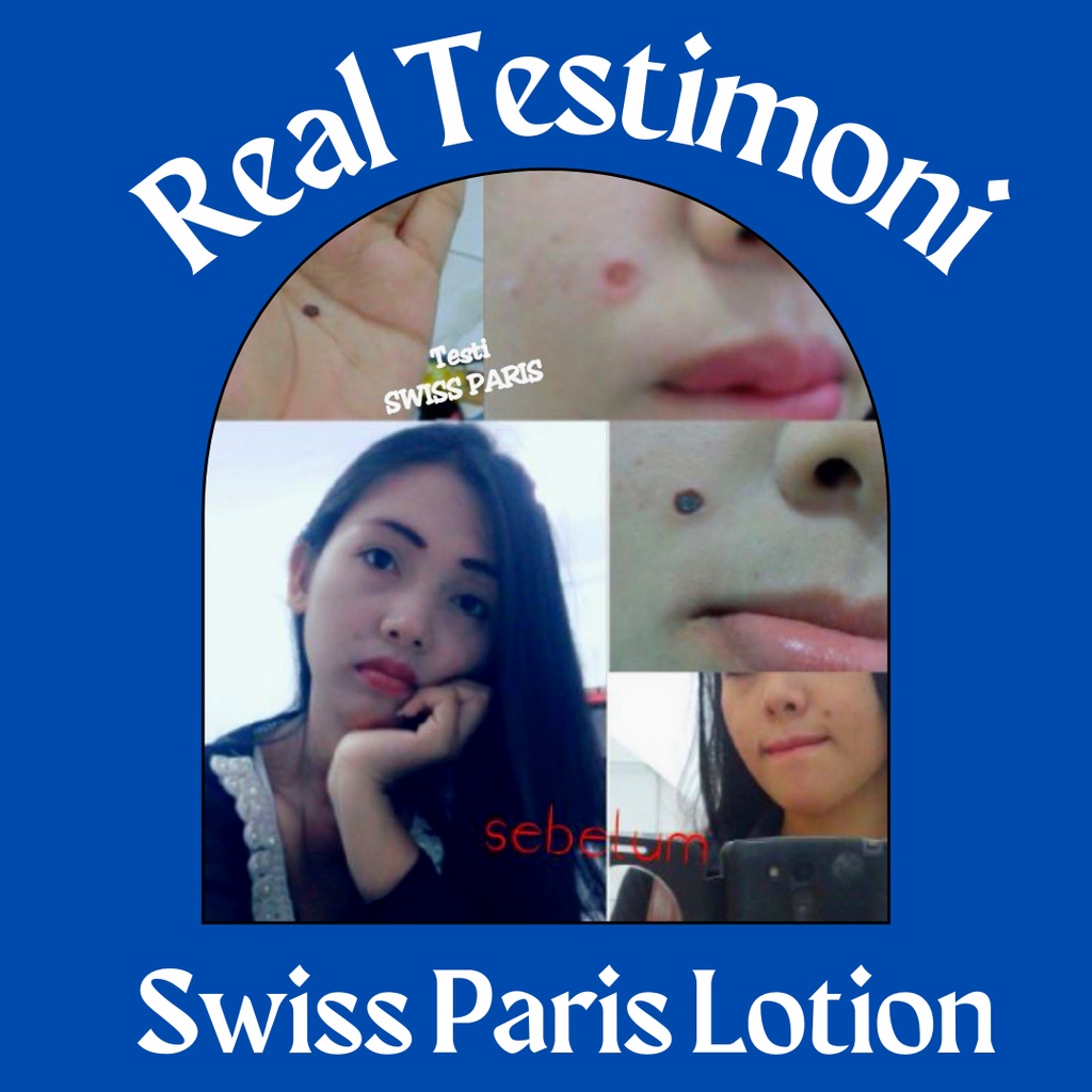 SWISS PARIS LOTION PENGHILANG KUTIL DAN TAHI LALAT ASLI HILANG PERMANEN
