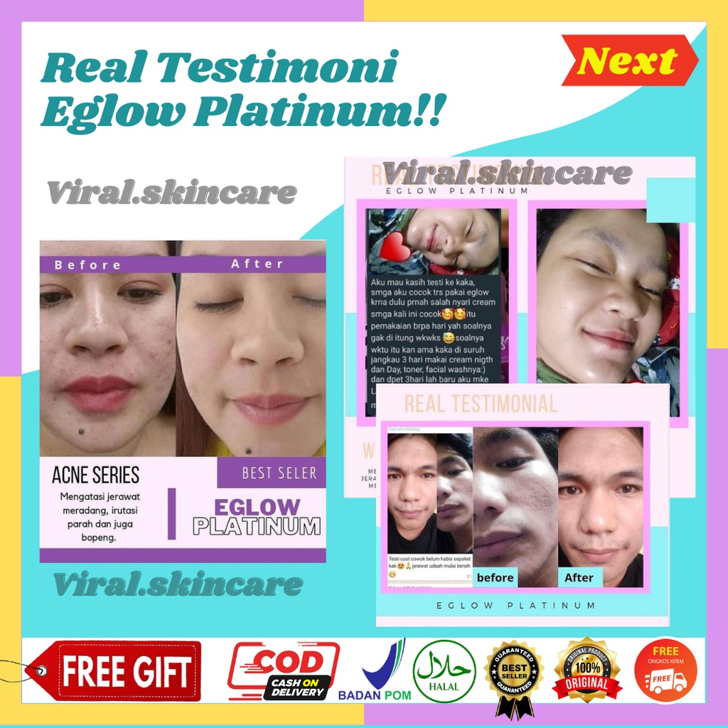 EGLOW PLATINUM BPOM - Skincare Paket Wanita Perawatan Wajah Kecantikan Glowing A16-5
