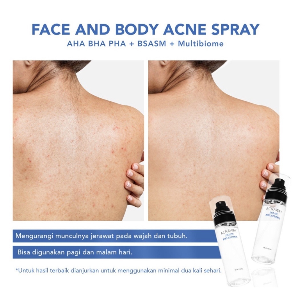 ACNAWAY Acne Face and Body Spray AHA BHA PHA + BSASM + Multibiome | Facial Mist | Acnaway Spray