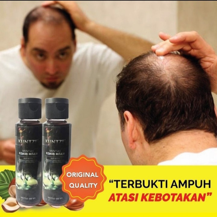 Jual Original Minyak Kemiri Untuk Rambut Rontok Menumbuhkan Rambut Botak Mencegah Timbulnya Uban Indonesia Shopee Indonesia