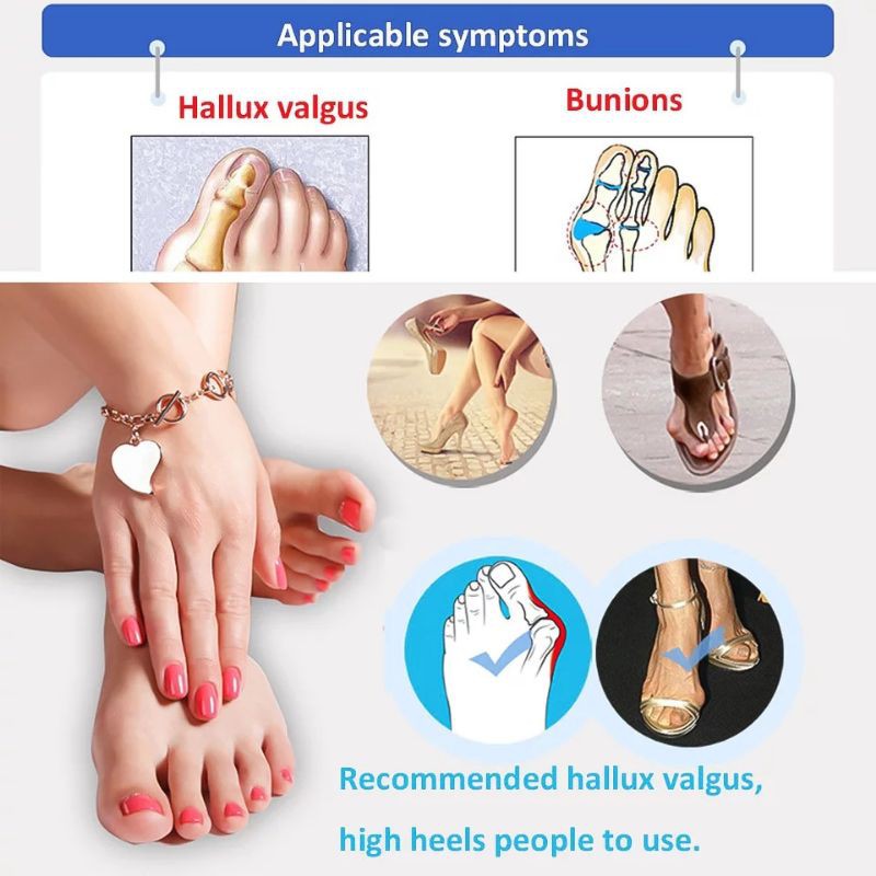 INSOLE ANTI HALLUX VALGUS BUNIONS INSOLE JARI KAKI INSOL WANITA JARI KAKI BENGKOK SOL IMPORT