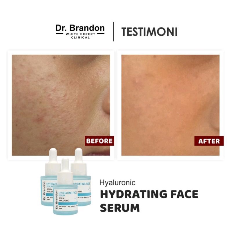 Serum Dr.Brandon Hydrating Face Serum