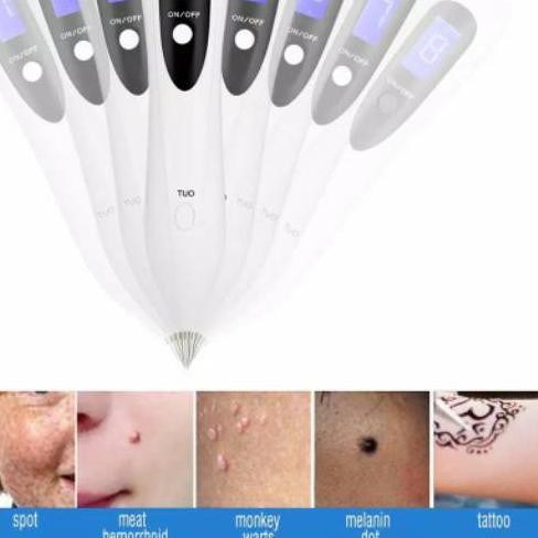 ❀ Soft cauter laser penghilang flek tai lalat kutil tatto bintik hitam melasma milia plasma pen ♦