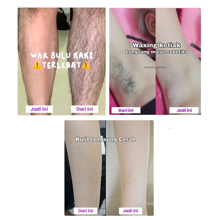 SUGAR WAX WAXING KIT / PENGHILANG BULU RAMBUT KETIAK KAKI TANGAN PERMANEN RANDOM ORIGINAL