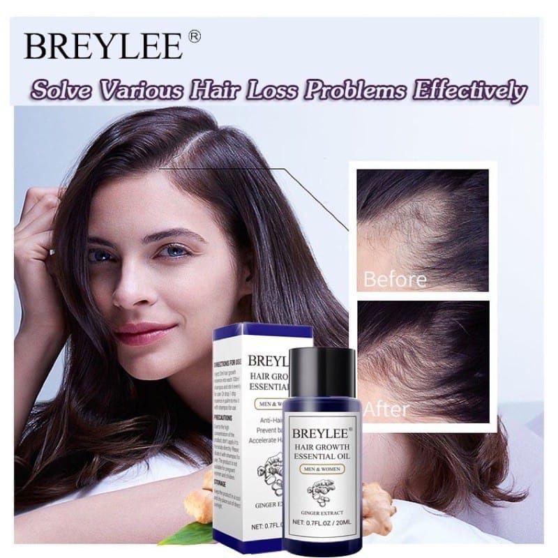 BREYLEE HAIR GROWTH ESSENTIAL OIL HAIR TREATMENT 20ml Anti-hair Loss hair care PENUMBUH RAMBUT