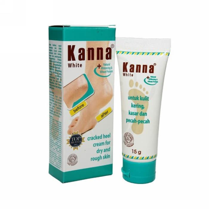 KANNA KRIM WHITE  TUBE / KRIM KAKI KANA 30g