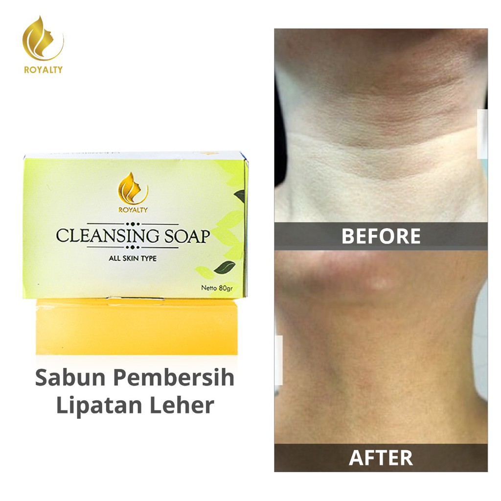 Sabun Pemutih Penghilang Daki Area Lipatan Leher Ketiak Royalty Brightening Soap Herbal Bpom Shopee Indonesia