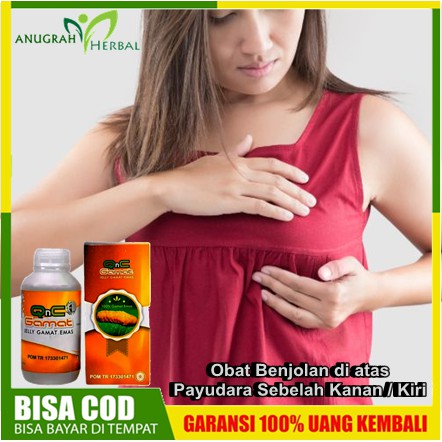 Obat Benjolan Payudara  Sebelah di Kanan/Kiri Besar/Kecil - Timbul Karena Kista payudara, Fibroadeno