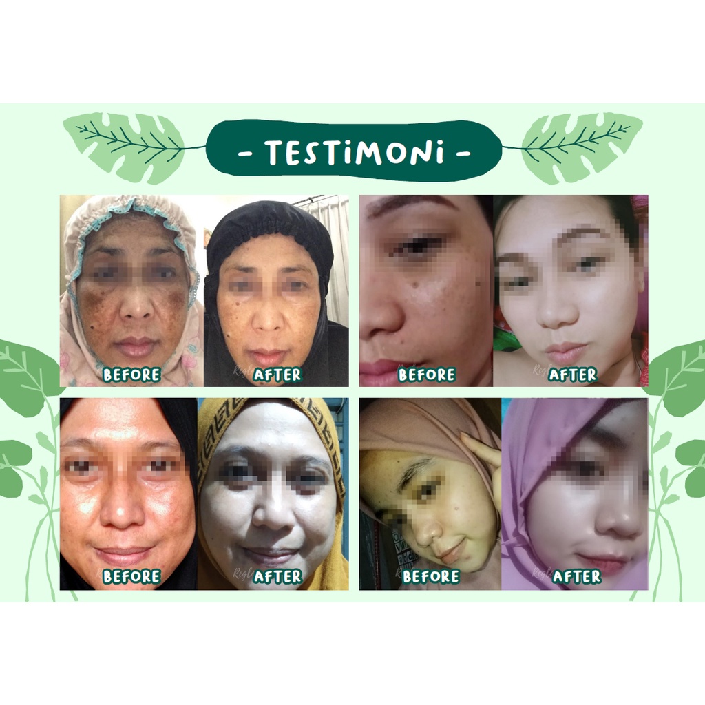 REGLOW Glowing Skin Treatment Paket Lengkap ORIGINAL 100% BPOM Skincare dr Shindy Putri Pemutih Pencerah Wajah Free Pouch Premium Termurah-4