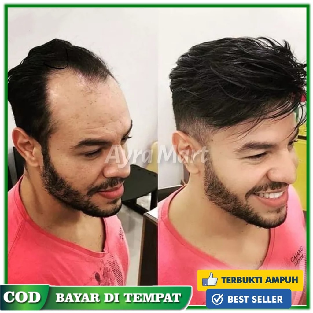Penumbuh rambut secara cepat dan tebal Hair tonic penumbuh rambut botak cepat Shampo penumbuh rambut