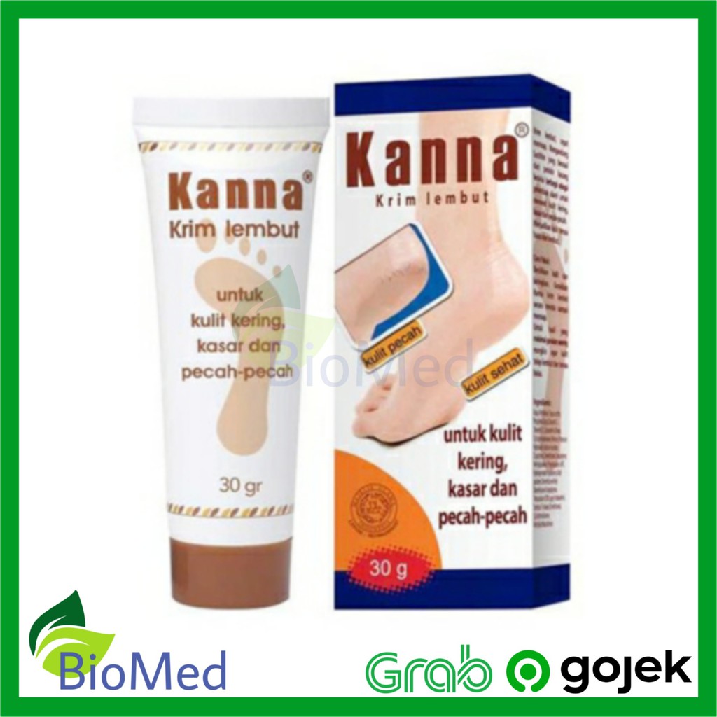 KANNA KRIM 30 gr - Kulit Kering Pecah Kaki Kasar