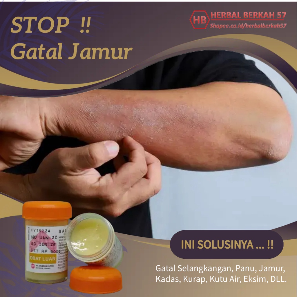 Salep Obat Gatal Eksim Kering Basah Menahun Paling Ampuh Kurap Kudis Selangkangan Jamur Kulit Gatel-8