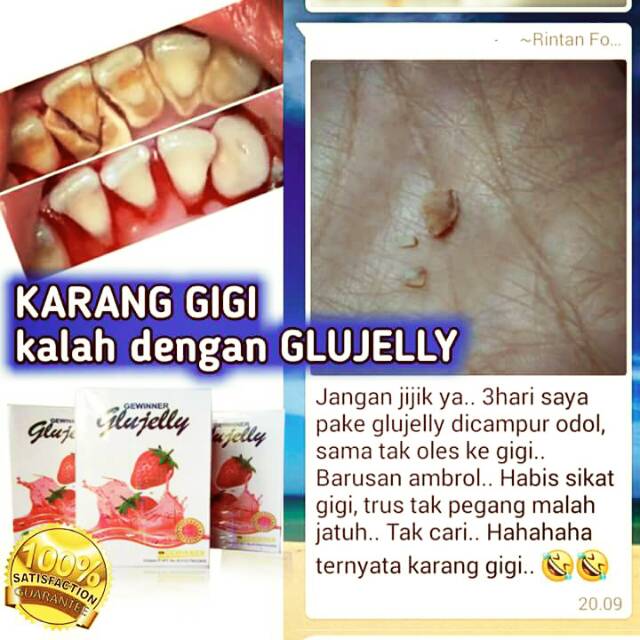 

Glujelly