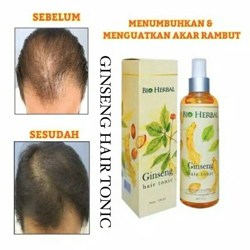 BIO HERBAL#HAIRTONIC Ginseng Original #Hair tonic rambut#Tonic rambut rontok#hair tonic ginseng