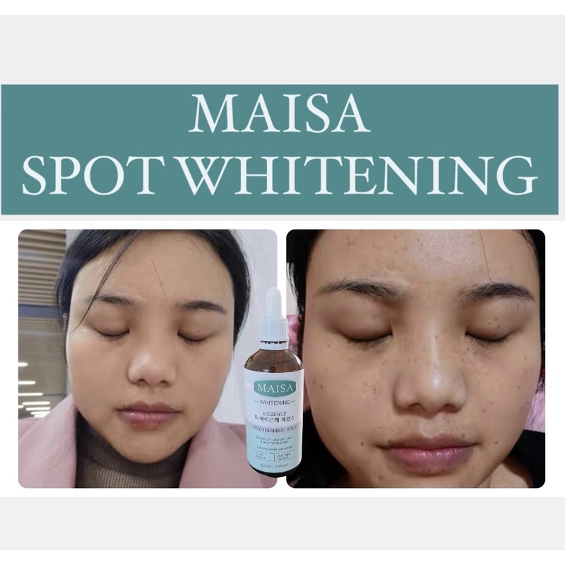 MAISA SPOT WHITENJNG ESSENCE