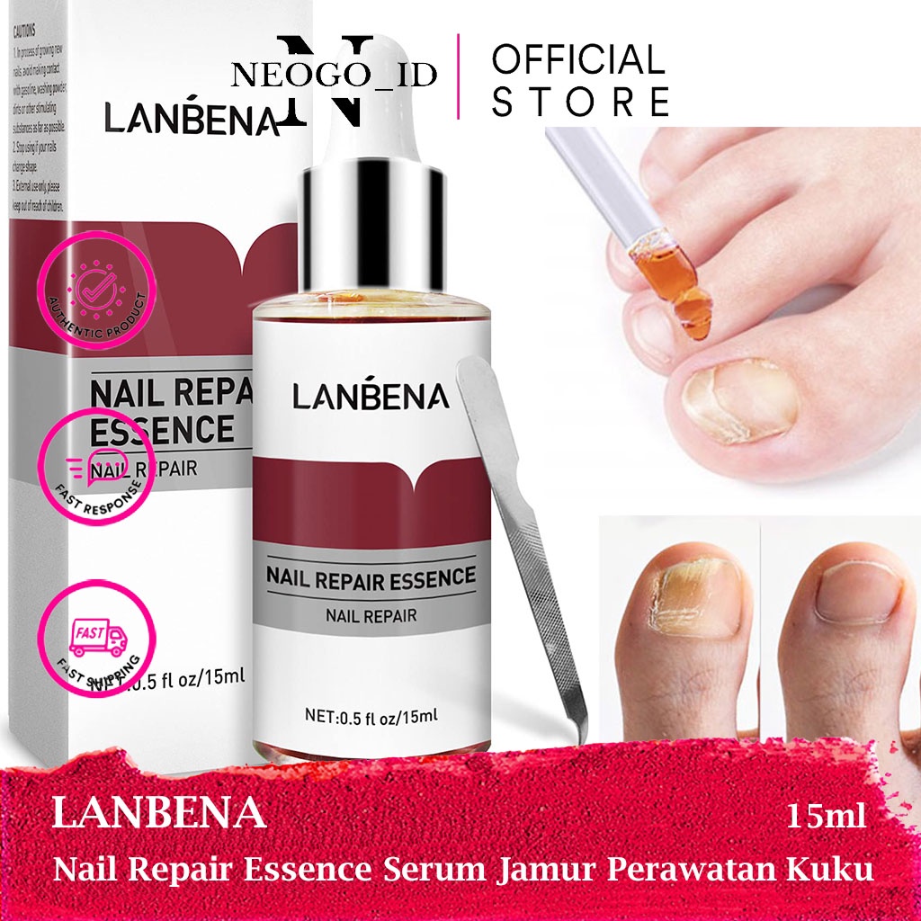 LANBENA Serum Obat Kuku Jamur Dan Rusak Nail Repair Essence Oil Serum Nail Treatment Ampuh Banget