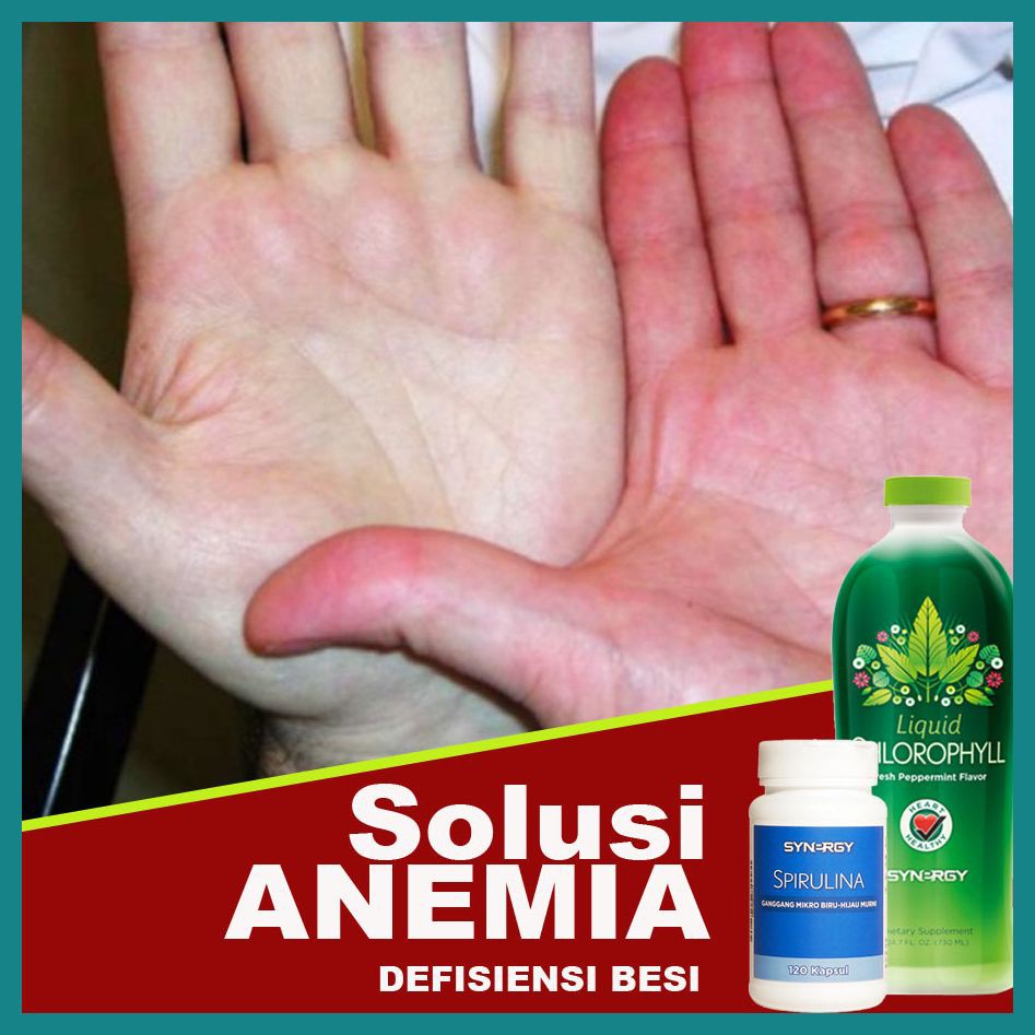 PAKET OBAT HERBAL Penambah Darah (Klorofil + Spirulina Synergy)