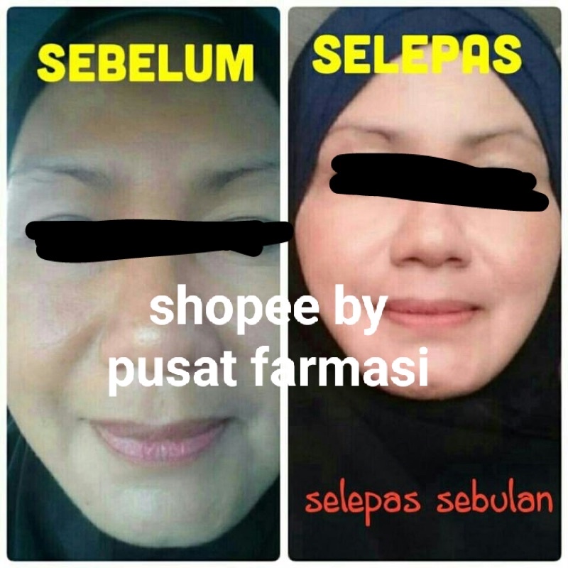 CREAM MALAM WHITENING BEADS HIJAU