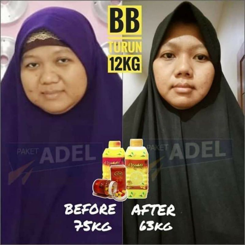 D LEMONIE APEL SUPER - APEL SUPER SI LAXING - pelangsing murah