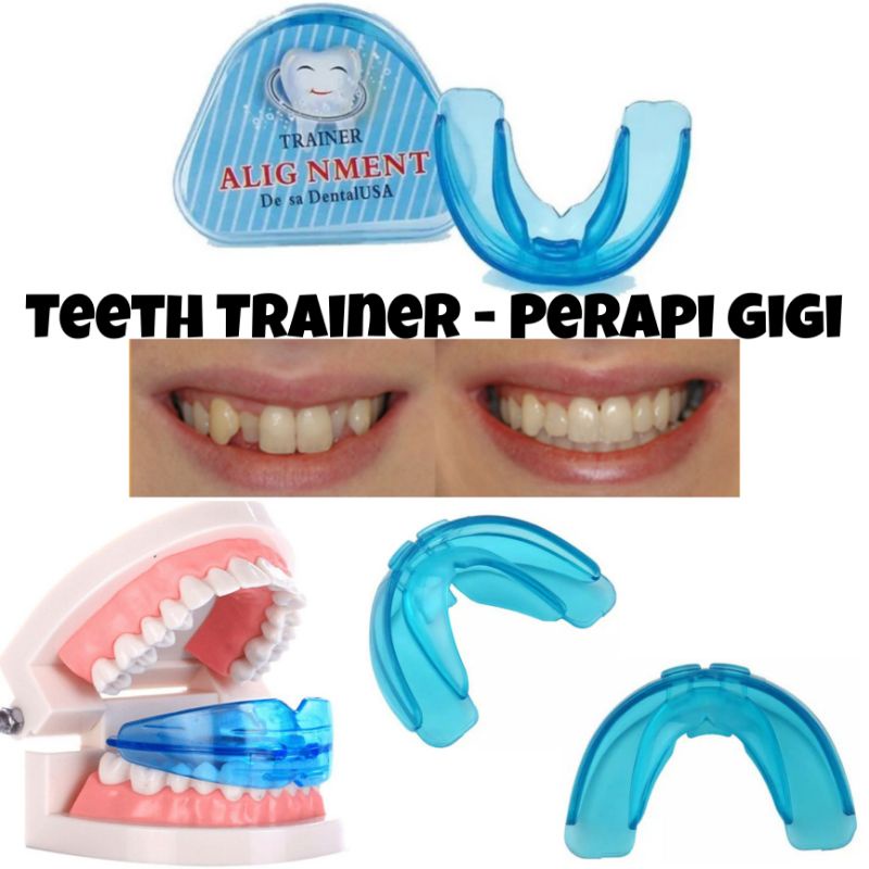 Teeth Trainer Alignment Orthodentic Alat Perapi Gigi Lepas Pasang Made In USA - Alat Perapih Gigi Tanpa Kawat Behel