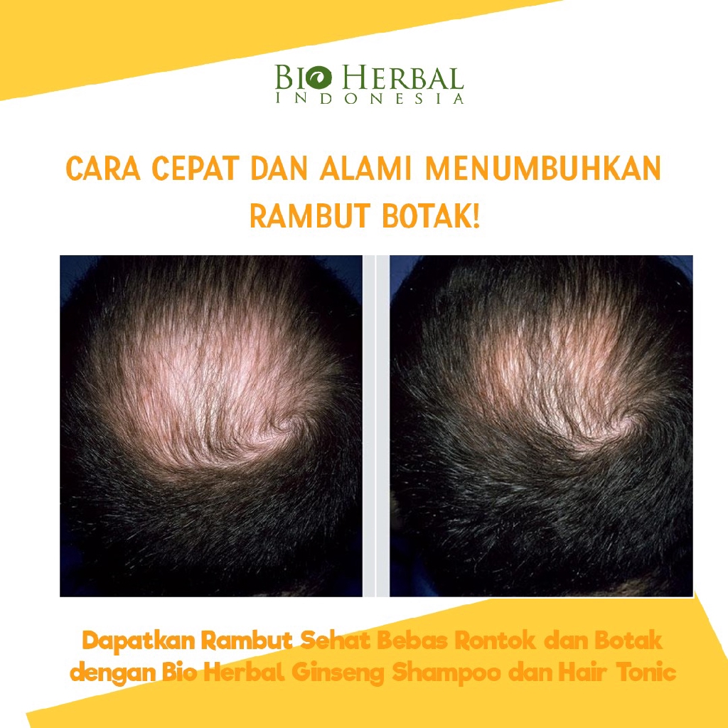 Paket Bio Herbal Shampoo &amp; Hair Tonic sampo tonik ginseng penumbuh kecantikan perawatan pemanjang penyubur rambut botak dan rontok parah kering pria wanita bio herbalzz