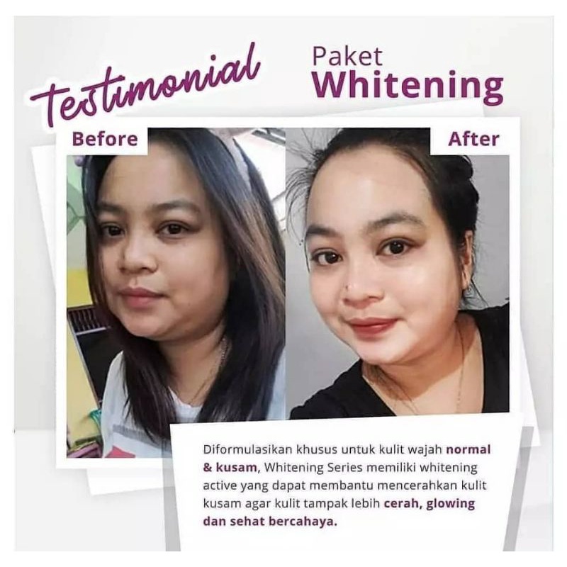 Paket Whitening + Red Jelly Lactobacillus || MS GLOW FREE POUCH