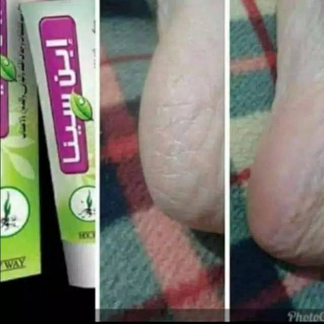 CantikQ- Ibnu Sina my way Cracked feet Cream
