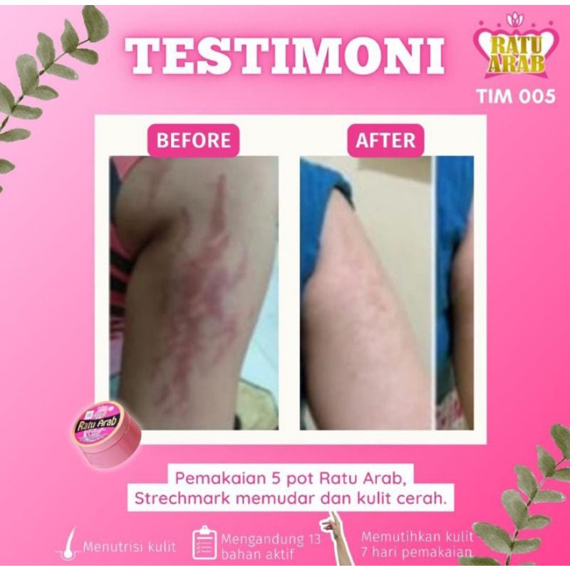 Original Bibit Ratu Arab Hand & Body Lotion (AGEN RESMI BEKASI)