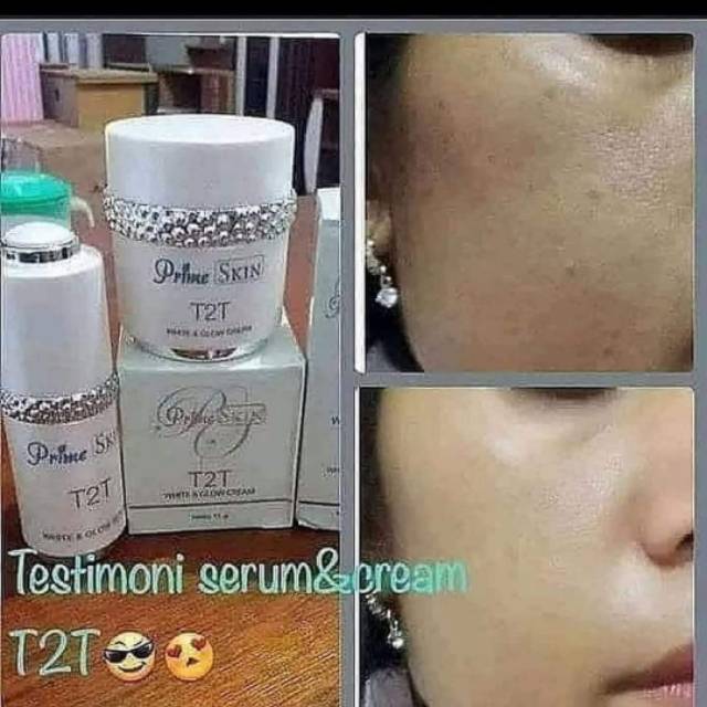 Serum dan cream T2T
