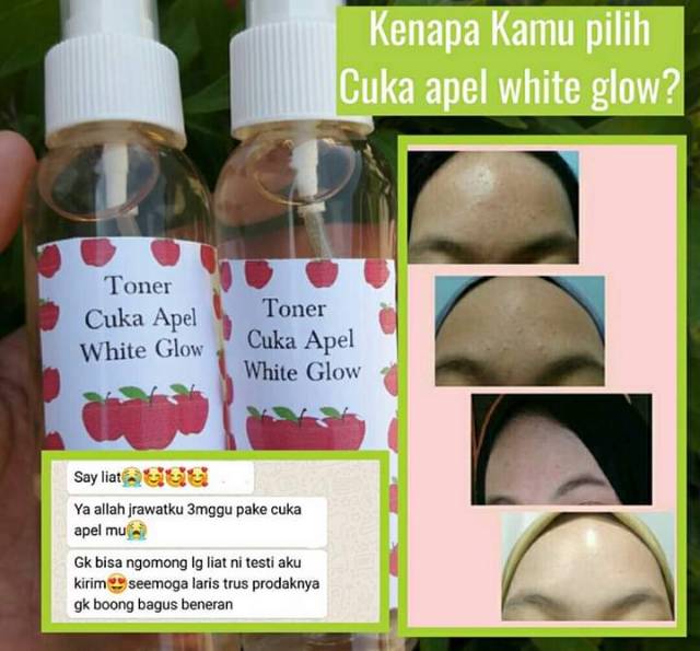 Cuka Apel White Glow Indonesia