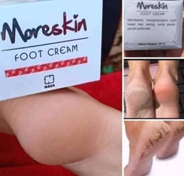Moriskin Foot Crem Nasa