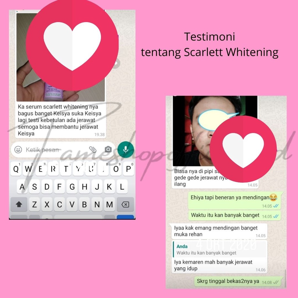 FAMESHOP - SCARLETT WHITENING BODY LOTION  HANDBODY BRIGHTNING/Mencerahkan/Memutihkan/ New JOLLY