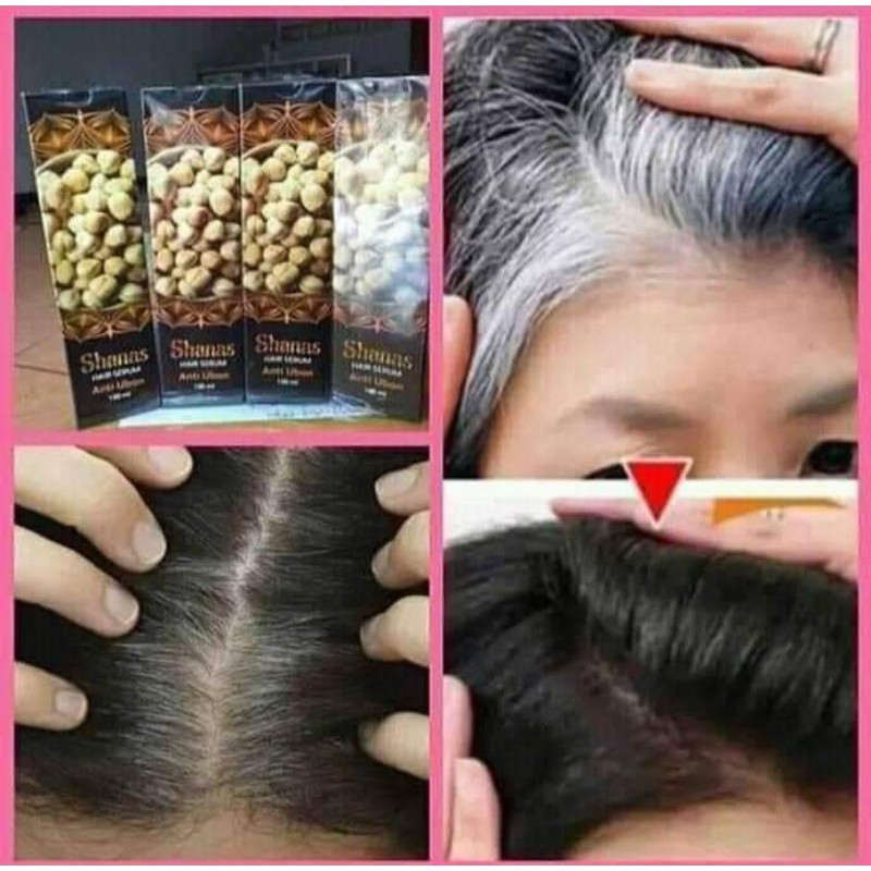 SHAMPO ATASI RAMBUT BERUBAN