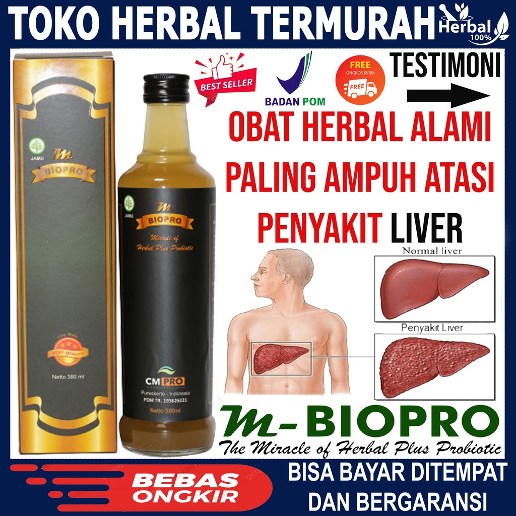 Obat Penyakit Hati-Obat Sakit Liver-Obat Penyakit Kuning-Hepatitis A-Hepatitis B-Hepatitis C Herbal