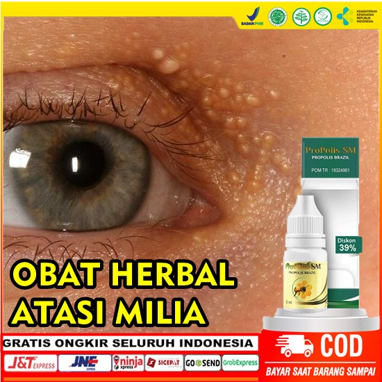 Obat Tetes Herbal Penghilang pengempis Bruntusan Bruntusan Milia Di