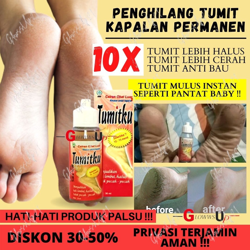 TUMITKU OBAT KAKI PECAH TUMITKU 60ML OBAT HERBAL MENGATASI KAKI PECAH PECAH 60ML ORIGINAL BPOM