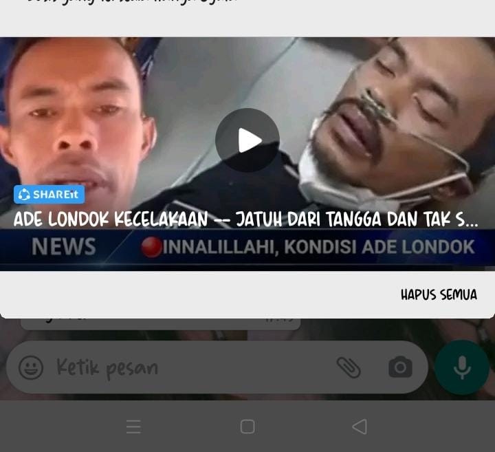 Tunik Shibori Black Tunik Batik Tunik Sibori Modern Monocrome Kerja Kantor Seragam Tunic Monokrom