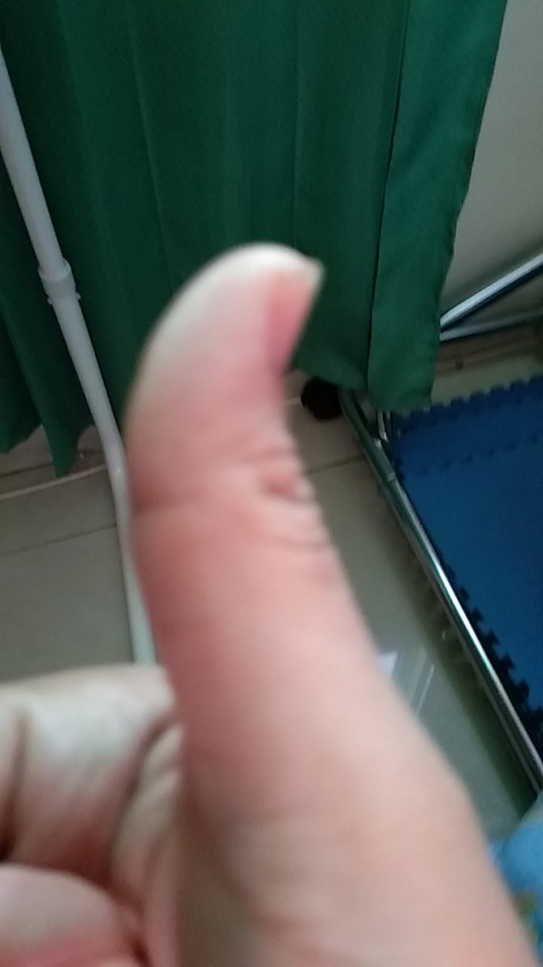 Alat Pemisah Kuning Putih Telur/saringan Telur/alat Dapur