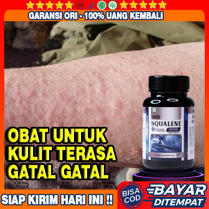 Obat Kulit Gatal Gatal - Obat Penyakit Kulit - Obat Dermatitis - Obat Bersisik - Obat Ruam Merah - O