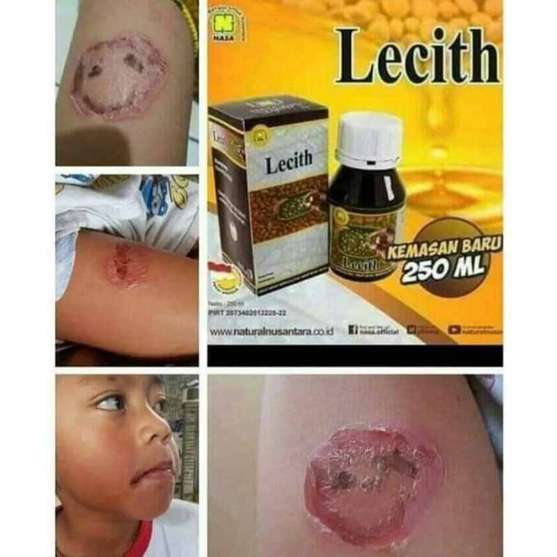 

LECITHIN ECER 20 ML / OBAT HERBAL
