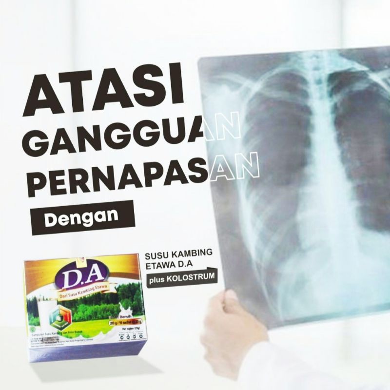 

D.A SUSU KAMBING ETAWA PLUS KOLOSTRUM D.A SUSU GEMUK BADAN / ATASI MASALAH PERNAPASAN