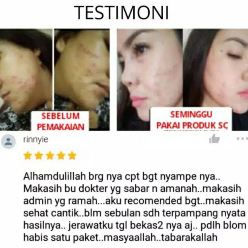 FACIAL WASH TEA TREE OIL SC-SEHAT CANTIK