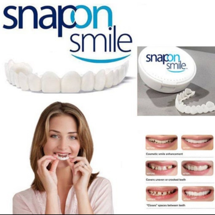 Snap On Smile Denture Elastic Removable Veneer Teeth Gigi Palsu