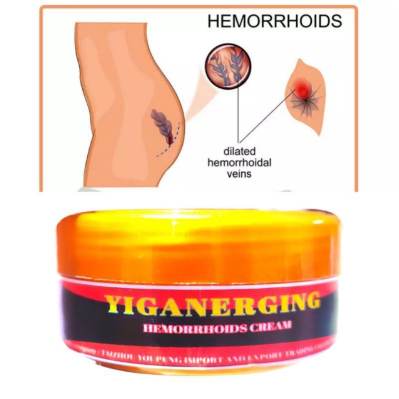 salep wasir yiganerging ampuh