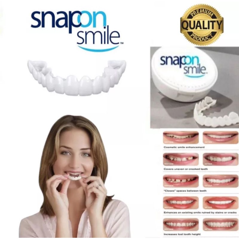 Sepasang Gigi Tiruan Instan Snap On Perfect Smile Atas Bawah
