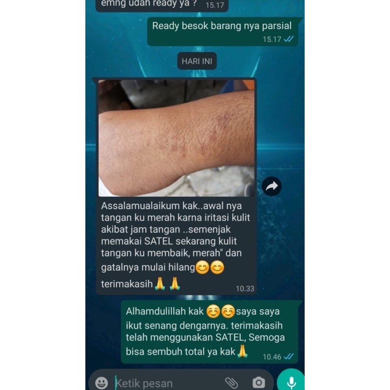 SATEL GTL ORIGINAL 100% Salep Gatel Ampuh Atasi Panu Kadas Kurap Koreng Gatal Jerawat-1