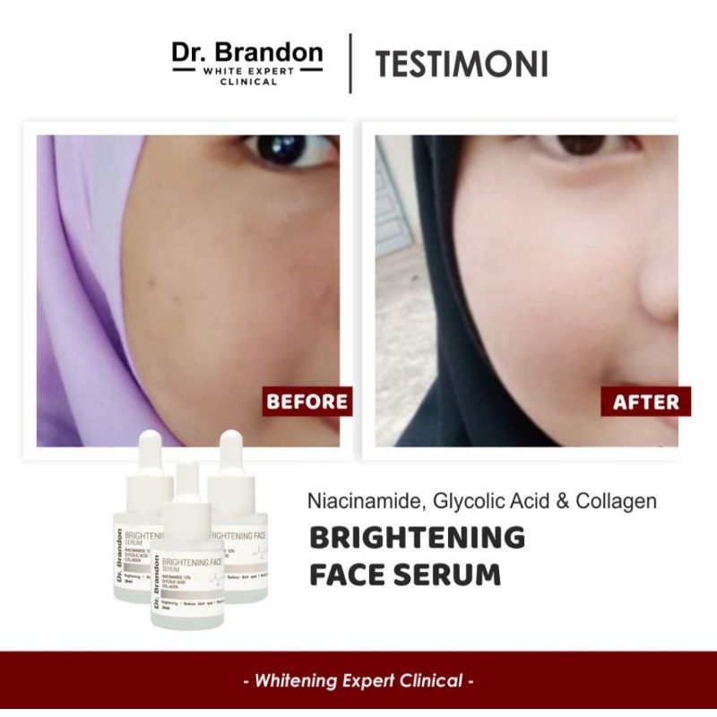 Serum Dr.Brandon Brightening Face Serum Niacinamide 10%