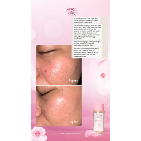 Toner Ohmyskin (Free Gift) Deep Brightening Rose Infuse Toner